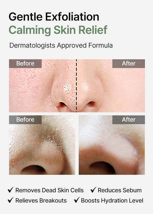 [CELIMAX] Jiwoogae Heartleaf Bha Peeling Pad