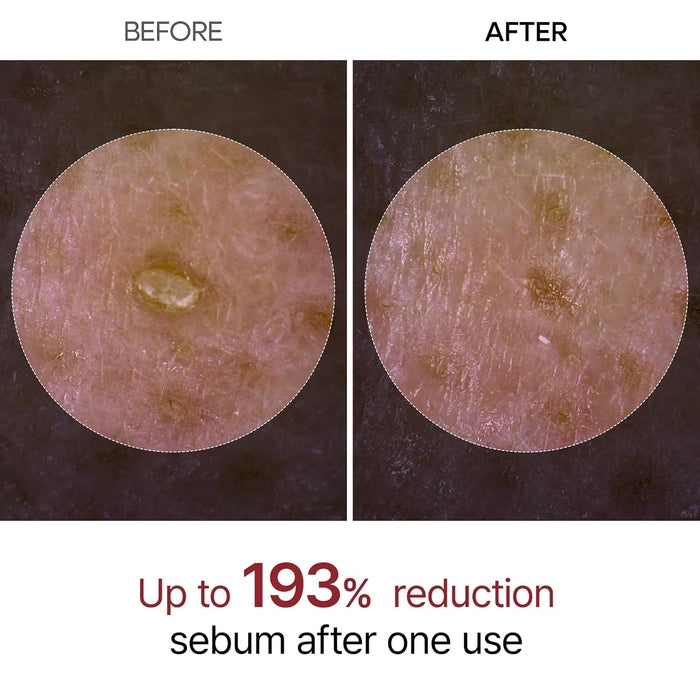 [DR.MELAXIN] Peel Shot Glow White Rice Peeling Ampoule