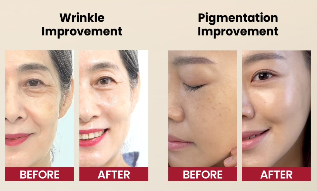 [KSECRET] SEOUL 1988 Serum : Retinal Liposome 2% + Black Ginseng