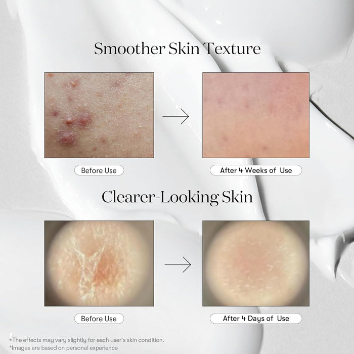 [VT] REEDLE SHOT 300